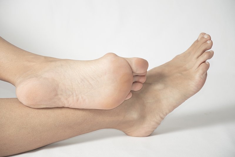 10 Things You Need to Know About Bunions
