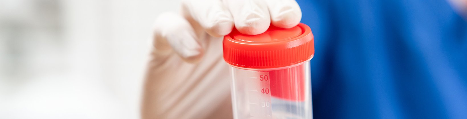 Substance Abuse Screening
