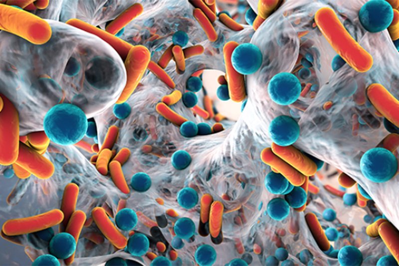 5 Ways to Protect Yourself From Germs