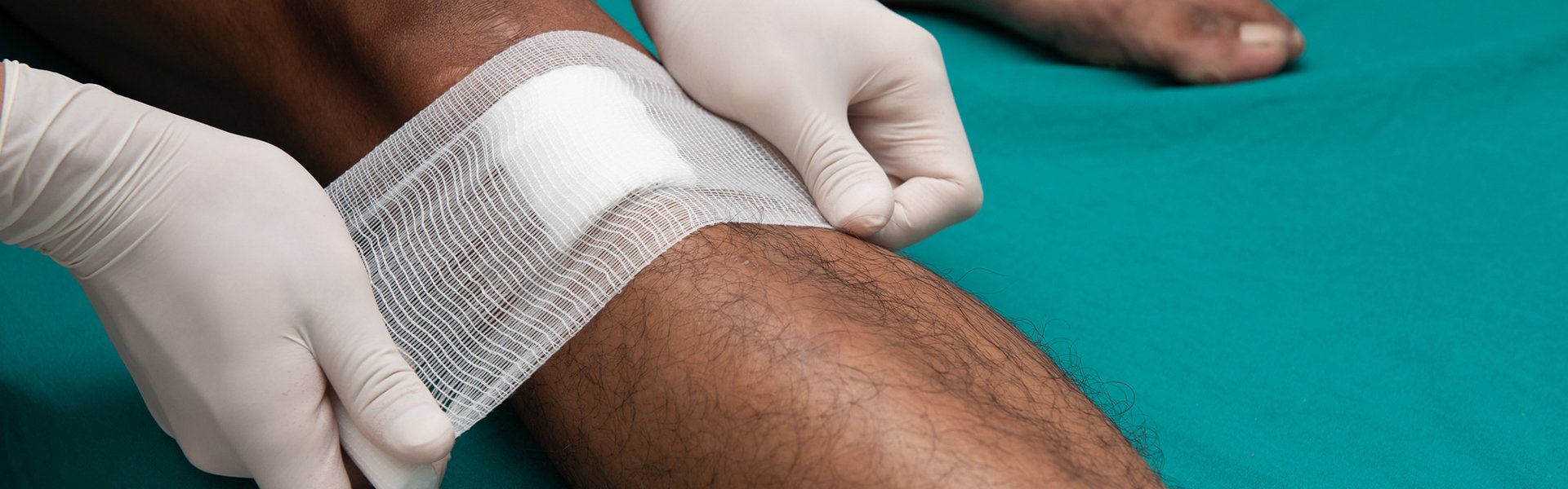 Bandaged Wound on Leg