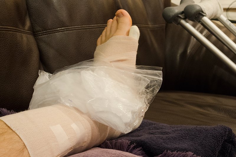 Ankle Sprain