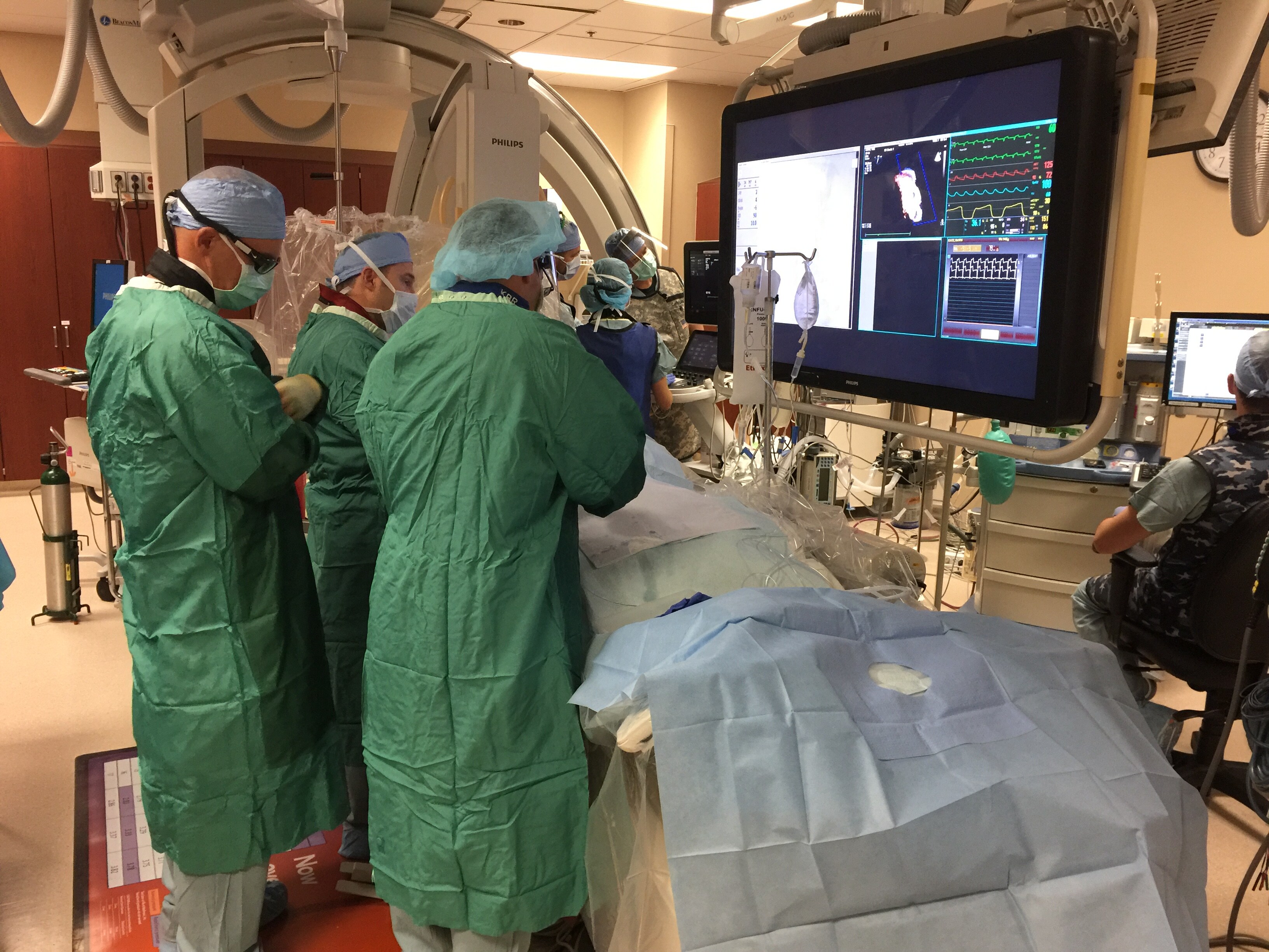 Watchman Procedure