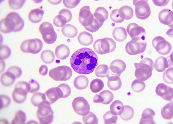 Microscope slide of immune system cells