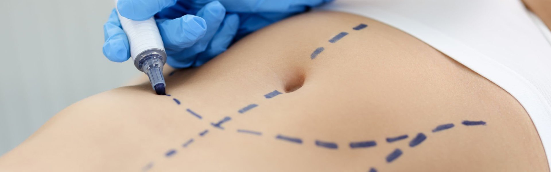 Body Plastic Surgery