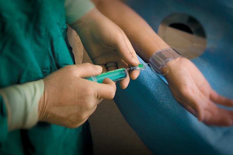 Radial catheterization
